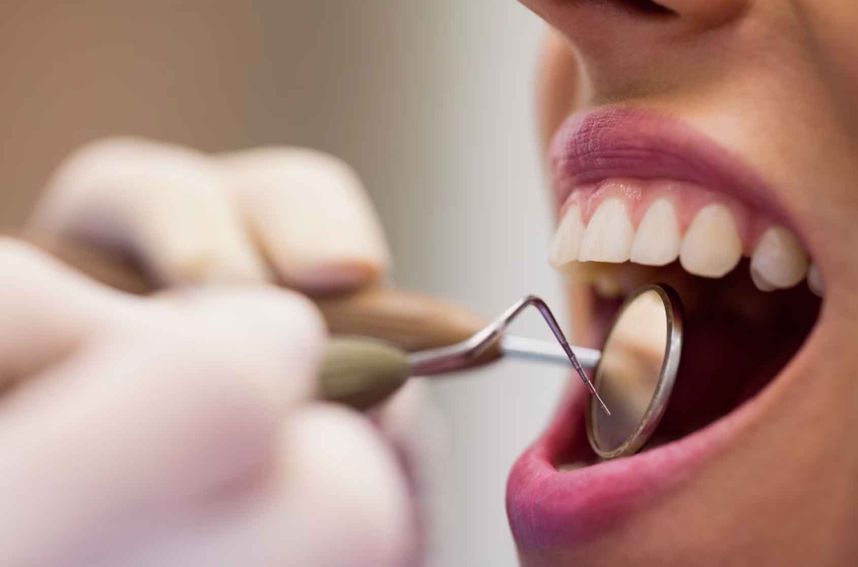 Кариес зубов при ортодонтическои лечении